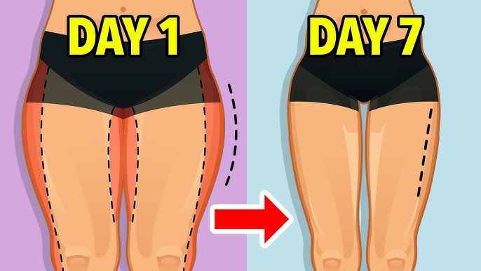 Thigh fat|थाई फैट कैसे कम करें? जानिए जांघों की चर्बी घटाने के प्राकृतिक और सुरक्षित तरीके। एक्सपर्ट्स की सलाह से बिना दवा और बिना जिम फैट कम करें।